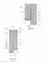 Fig. 06 - Devices, systems, and methods for prosthesis delivery and implantation