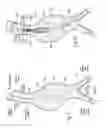 Fig. 32 - Devices, systems, and methods for prosthesis delivery and implantation