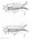 Fig. 40 - Devices, systems, and methods for prosthesis delivery and implantation