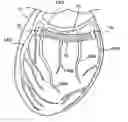 Fig. 01 - Devices and methods for heart valve treatment