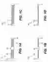 Fig. 02 - Devices and methods for heart valve treatment