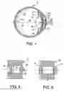 Fig. 02 - Bifocal intraocular telescope for low vision correction