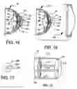 Fig. 06 - Bifocal intraocular telescope for low vision correction