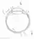 Fig. 02 - Method of implanting an intraocular lens