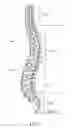Fig. 02 - Prostheses, tools and methods for replacement of natural facet joints with artificial facet joint surfaces