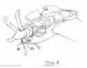 Fig. 03 - Air intake appliance for an aircraft engine