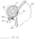 Fig. 09 - Depth adjustment mechanism