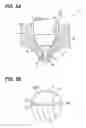 Fig. 04 - Fuel injection nozzle and method for manufacturing the same