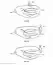 Fig. 13 - Apparatus and method for boosting sound in a denta-mandibular sound-transmitting entertainment toothbrush