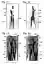 Fig. 08 - Active subject imaging with body identification