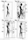 Fig. 09 - Active subject imaging with body identification