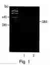 Fig. 02 - Methods and compositions for treatment of inflammatory disease using cadherin-11 modulating agents