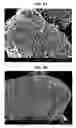Fig. 09 - Lithium transition metal oxide with gradient of metal composition