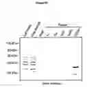 Fig. 06 - Medium and method for enriching, purifying or depleting atp binding proteins from a pool of proteins