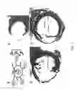 Fig. 06 - Non-invasive gene targeting to ocular cells