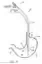 Fig. 45 - Remote tissue retraction device