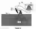 Fig. 07 - Method and instrument for minimally invasive sentinel lymph node location and biopsy