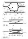 Fig. 02 - Device, system, and method for detecting, localizing, and characterizing plaque-induced stenosis of a blood vessel