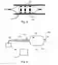Fig. 03 - Device, system, and method for detecting, localizing, and characterizing plaque-induced stenosis of a blood vessel