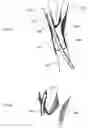 Fig. 09 - Endoluminal delivery of anesthesia