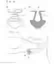 Fig. 06 - Lacrimal punctum plug