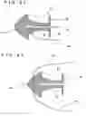 Fig. 13 - Lacrimal punctum plug
