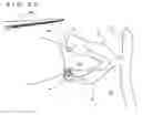 Fig. 17 - Lacrimal punctum plug