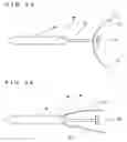 Fig. 20 - Lacrimal punctum plug