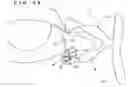 Fig. 30 - Lacrimal punctum plug