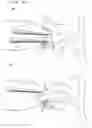 Fig. 31 - Lacrimal punctum plug