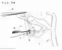 Fig. 32 - Lacrimal punctum plug