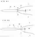 Fig. 34 - Lacrimal punctum plug
