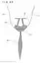 Fig. 41 - Lacrimal punctum plug