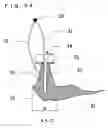 Fig. 43 - Lacrimal punctum plug