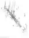 Fig. 22 - Injection systems