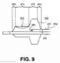 Fig. 05 - Vulnerable plaque treatment