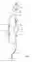 Fig. 02 - Large volume bolus device and method