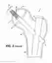 Fig. 04 - Intramedullary nail assembly