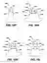 Fig. 12 - Intramedullary nail assembly