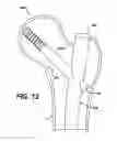 Fig. 15 - Intramedullary nail assembly