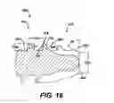 Fig. 17 - Intramedullary nail assembly