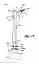 Fig. 18 - Intramedullary nail assembly