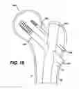 Fig. 20 - Intramedullary nail assembly