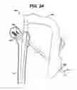 Fig. 25 - Intramedullary nail assembly