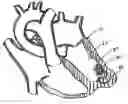 Fig. 01 - Catheter-based tissue remodeling devices and methods