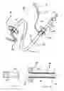 Fig. 02 - Catheter-based tissue remodeling devices and methods