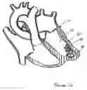 Fig. 08 - Catheter-based tissue remodeling devices and methods