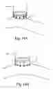 Fig. 09 - Systems and methods for delivering fastener to opposed tissue structures