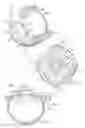 Fig. 02 - System and method for making incisions for scleral eye implants