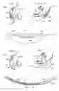 Fig. 16 - System and method for making incisions for scleral eye implants
